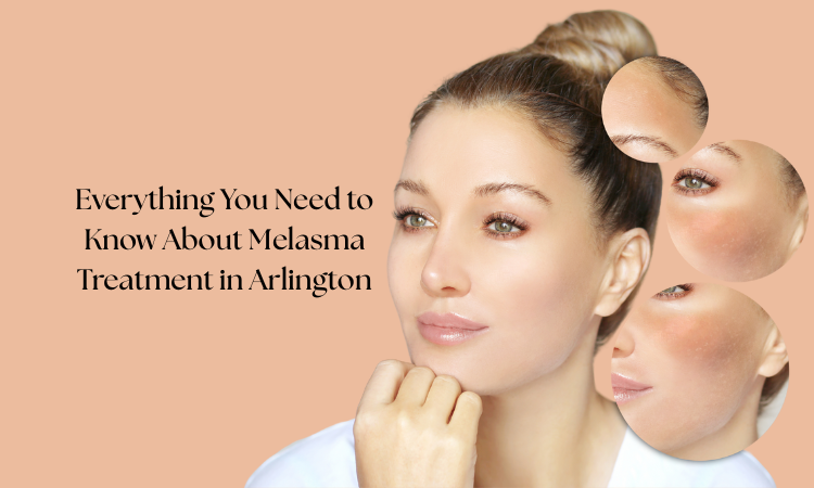 Melasma Treatment in Arlington