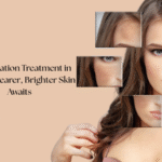 Pigmentation Treatment in DMV