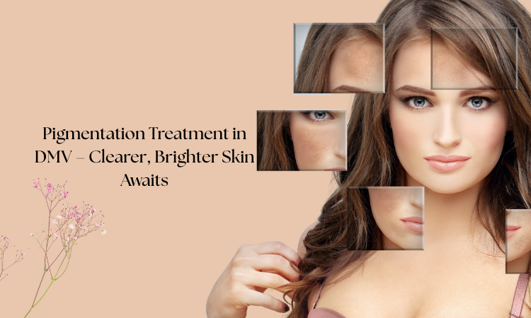 Pigmentation Treatment in DMV