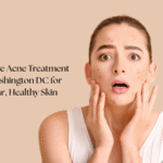 Acne Treatment in Washington DC
