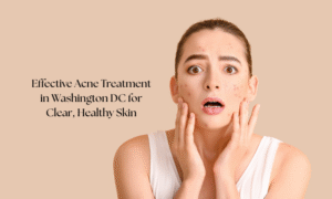 Acne Treatment in Washington DC