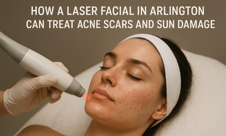 Laser facial in Arlington