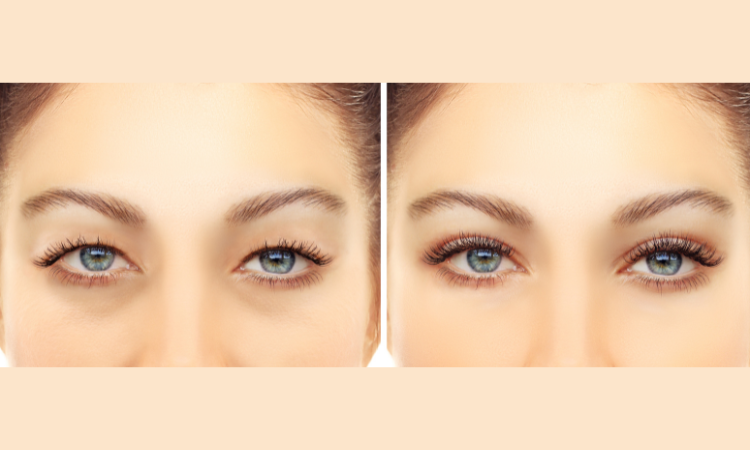 Lift, tighten, and refresh your eyes — no surgery, no scars.