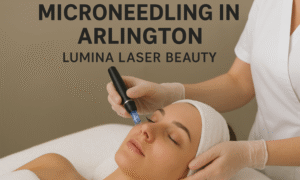 Microneedling in Arlington