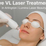 Dye VL Laser Treatments in Arlington