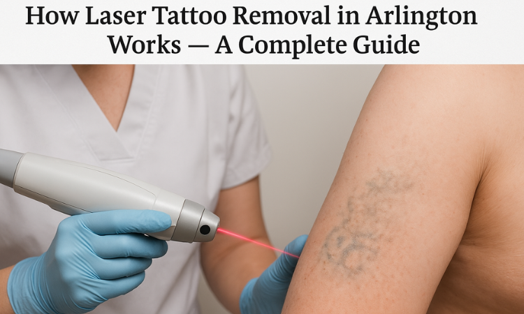 Laser Tattoo Removal in Arlington